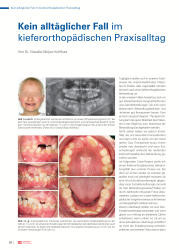 issueImage