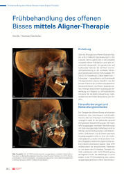 issueImage