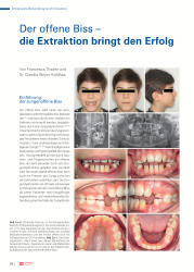 issueImage