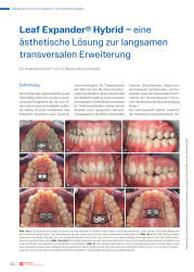 issueImage