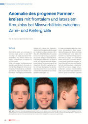 issueImage
