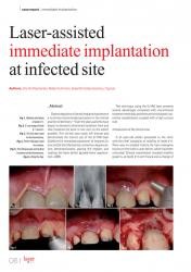 issueImage