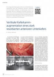 issueImage