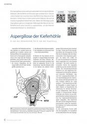 issueImage
