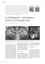 issueImage