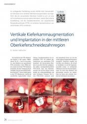 issueImage