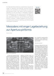 issueImage