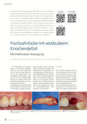 issueImage
