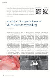 issueImage
