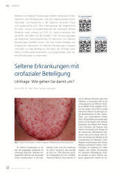 issueImage