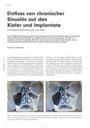issueImage