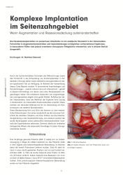 issueImage