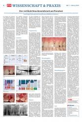 issueImage