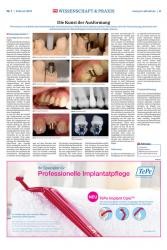 issueImage