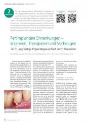 issueImage