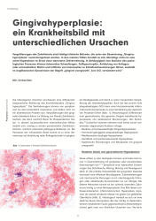 issueImage