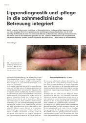issueImage