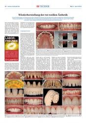issueImage