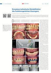 issueImage
