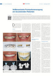 issueImage
