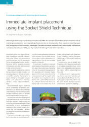 issueImage