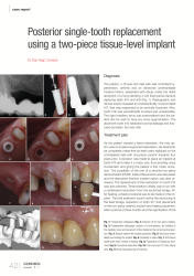 issueImage