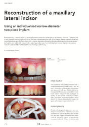 issueImage