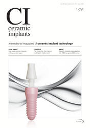 ceramic implants 01/25