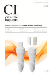 ceramic implants 02/25