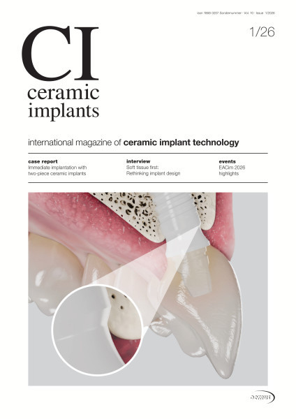 ceramic implants