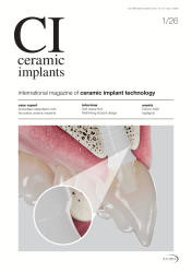 ceramic implants 01/26