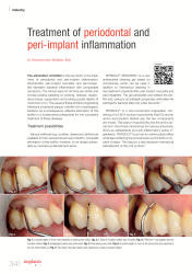 issueImage