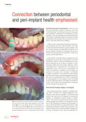 issueImage