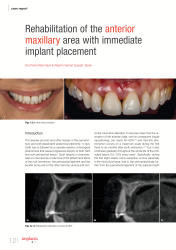 issueImage