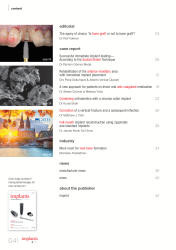 issueImage
