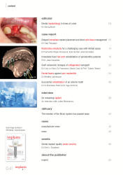 issueImage