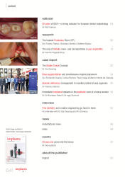issueImage