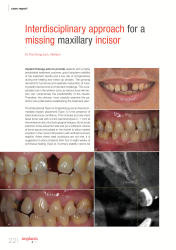 issueImage