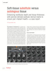 issueImage