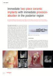 issueImage