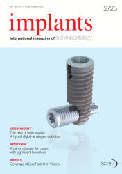 Implants 02/2025