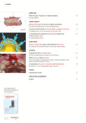 issueImage