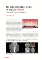 issueImage