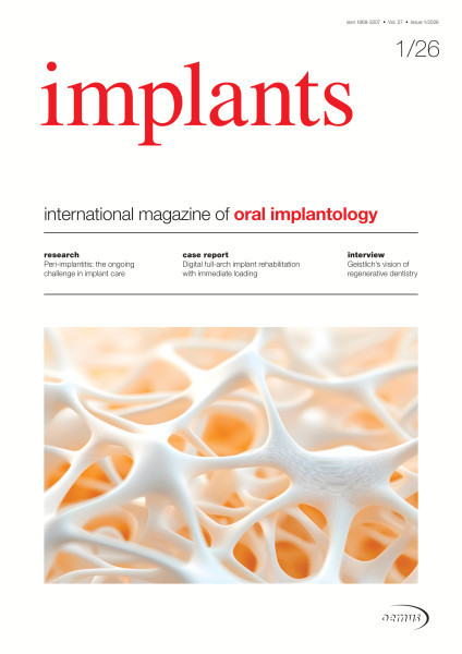 implants