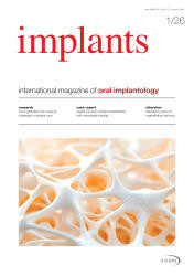 implants 01/26