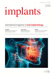 implants 02/26