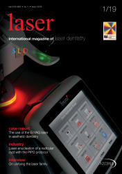 Laser 01/2019