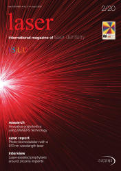 Laser 02/2020