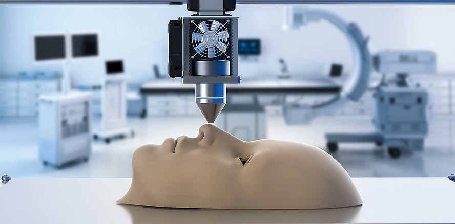Gesichtsimplantate: Künstliche Intelligenz trifft 3D-Druck