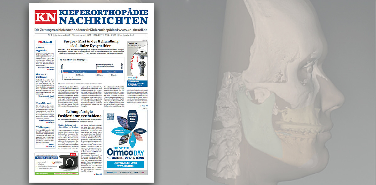 Neue KN online: Möglichkeiten und Grenzen des Surgery First-Konzepts